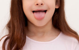 舌痛症(ぜっつうしょう)